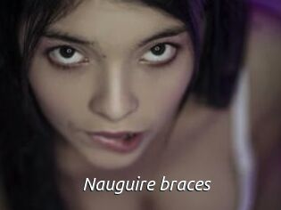 Nauguire_braces
